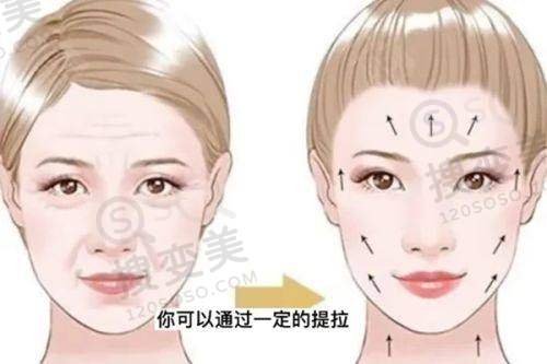 泉州自体脂肪隆胸要多少钱?海峡/美莱等医院价格及医生技术揭秘
