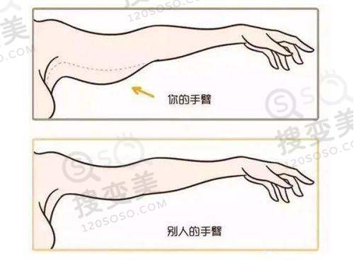 泉州自体脂肪隆胸要多少钱——其他医院情况