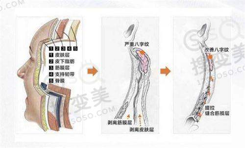 泉州华厦眼科医院林巧雅医生所在医院情况