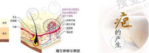 汇总泉州市做假体隆胸比较好的医院，美莱/欧菲/海峡口碑优价格合理