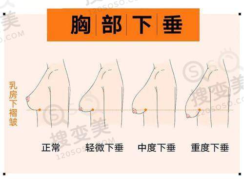 长沙整形美容医院排名前十，爱思特/艺星/雅美等技术优口碑好值得选 