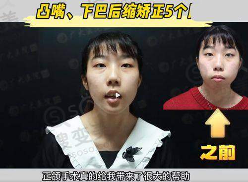 长沙整形美容医院排名前十之选择建议