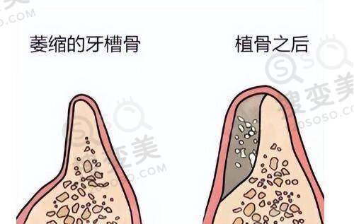 长沙星呈凯莱医疗美容怎么样之特色项目优势