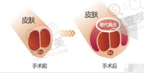 长沙正颌手术医院排名及费用揭秘!亚韩赵贵庆技术优价格合理