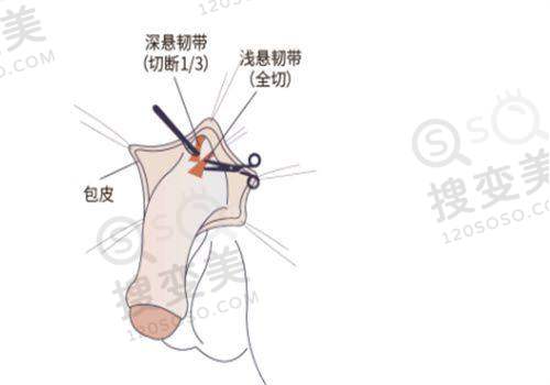 长沙做人鱼体雕医院有哪些——总结与建议