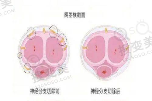 长沙整形美容医院在线预约之爱思特张姣姣医生