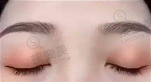 长沙好的眼科医院排名前十名之湖南长沙睛点眼科门诊
