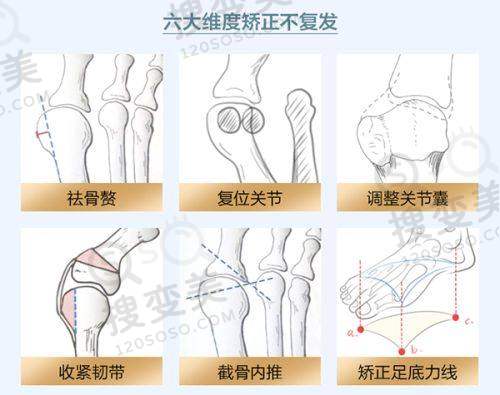 全新长沙去眼袋医院排名榜前十，艺星/雅美/协雅等技术优口碑好