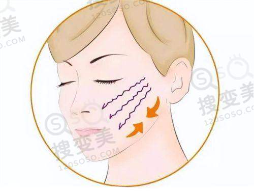 长沙星呈凯莱医疗美容怎么样？正规靠谱收费合理，隆鼻吸脂口碑佳 