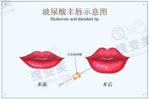 长沙雅美眼综合哪个医生好之姚江华手术顾客反馈与价格