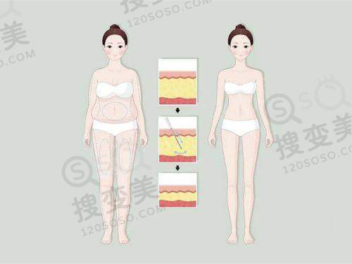 长沙雅美整形医院在哪——医院医生团队