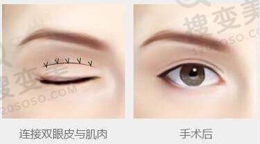 长沙眼科医院哪个好之裕湘医院眼科