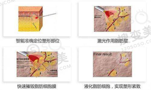 长沙整形美容医院排名前十之综合整形医院