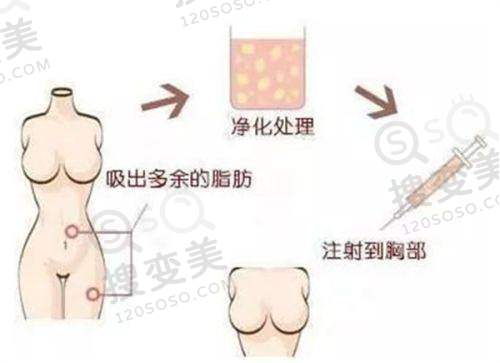 长沙超声炮认证医院名单中的特色医美门诊部