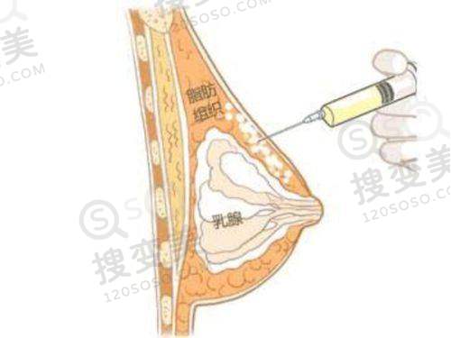 长沙乔雅登法定合作医院名单之选择建议