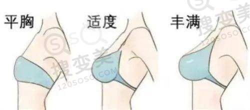 长沙体雕整形医院排名前十之部分医院体雕技术特色