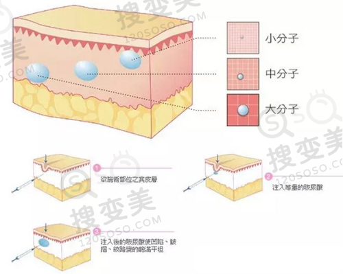 长沙少女针哪里打？华韩华美/雅美等官方认证医院及医生值得选 