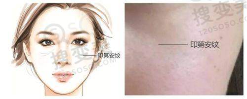 长沙眼科医院哪个好之目宁眼科