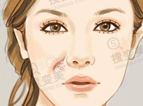 长沙好的眼科医院排名前十名之长沙优视美眼科医院