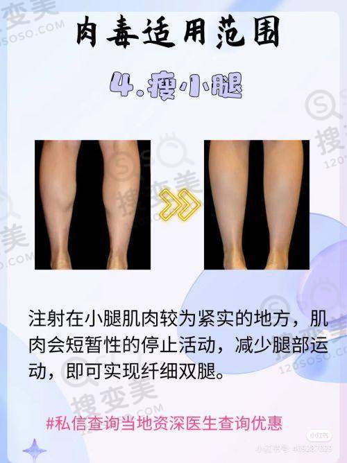 全新长沙去眼袋医院排名榜前十之选择建议