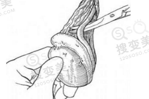 贵阳轮廓固定医院排名榜前十名单之贵阳美莱微整形医院