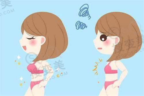 上海华美医院丰胸手术多少钱——如何选择适合自己的丰胸方案