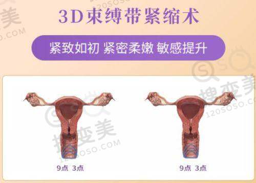 贵阳耳畸形修复哪里好?贵阳惠爱医疗美容独具特色