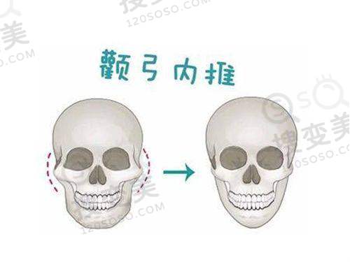 武汉五洲隆胸价格表更新:常见隆胸项目价格