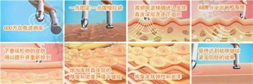 武汉艺星做曼托圆盘光面假体隆胸价格:杨国梁医生相关价格