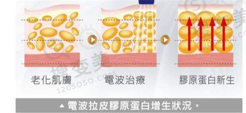武汉艺星杨国梁动感舒适丰胸技术优势