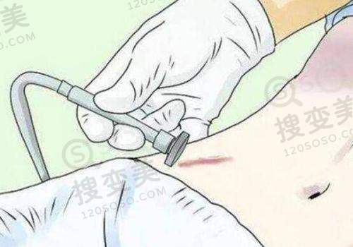 贵阳耳畸形修复哪里好?贵州省人民医院相关科室实力强劲