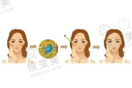贵阳正规祛斑医院哪家好——利美康祛斑的正规性与可靠性