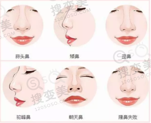 上海华美医院丰胸手术多少钱——与其他医院的价格对比