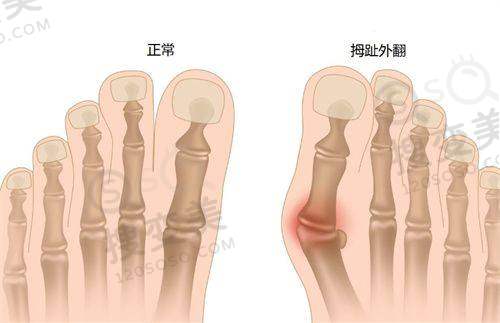 吕方中眼修复可信吗?零失败记录/透明收费/多方式挂号超便捷