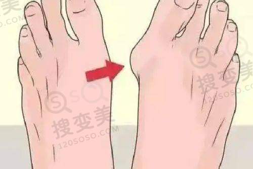 吕方中医生修复双眼皮口碑好之技术优势