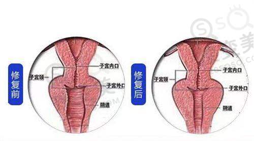 广州双眼皮王擎医生简介之总结