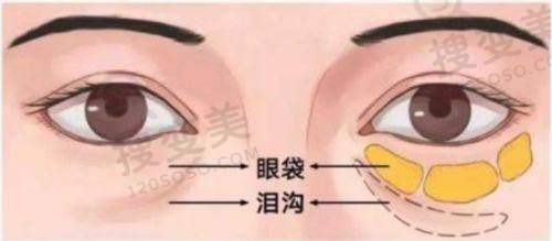 吕方中属于什么档次？从真人实例看成效档次