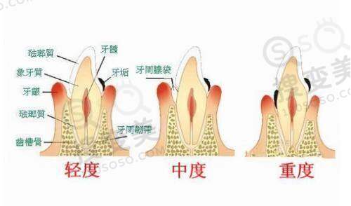 广州十大下眼睑提升医院排名之技术优势对比