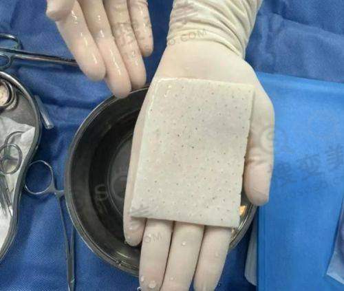 钟杰光医生口碑特别差?——真人实例见证神奇成效
