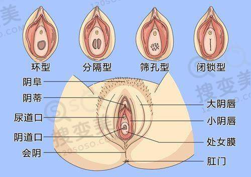 广州新市医院整形科失败实例全是造假:行业启示与求美者建议
