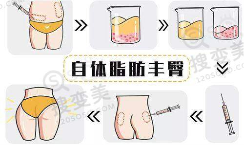 广州眼周筋膜提升医院排名前十2025之部分医院上榜理由