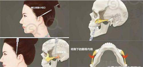 经验总结!2025国内脸颊异物取出十大医院排名之部分医院详细情况