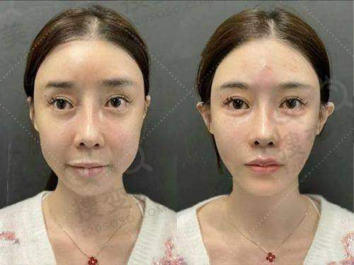 广州取生长因子有影响力的医生排名之谭新东医生