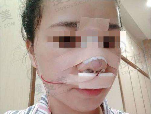 广州新市医院医疗美容科靠谱吗之服务质量篇