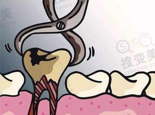 武汉做种植牙价格多少钱?优益佳口腔医院收费详情