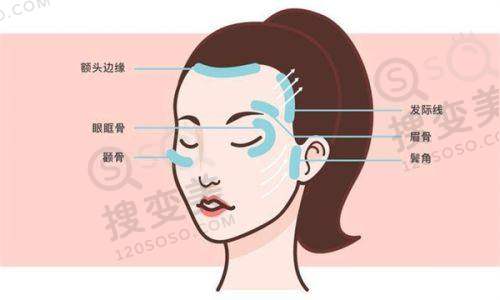 吕方中预约10天就收费是谣言,手术费用明细说明