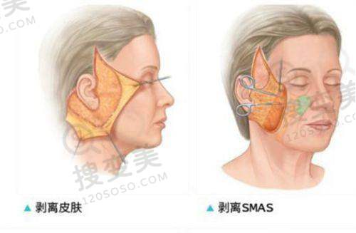 广州馒化脸修复医生认证名单之钟杰光