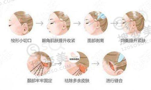 吕方中为什么经常换医院？广州新市医院的设备与学术优势
