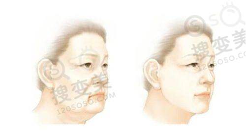 广州男士必看!广州男士阴茎增大增粗十大医院排名之区域差异分析