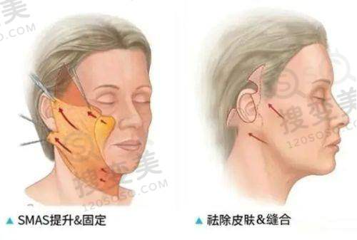 莫志波医生在广州排第几名？所在医院的强大背景